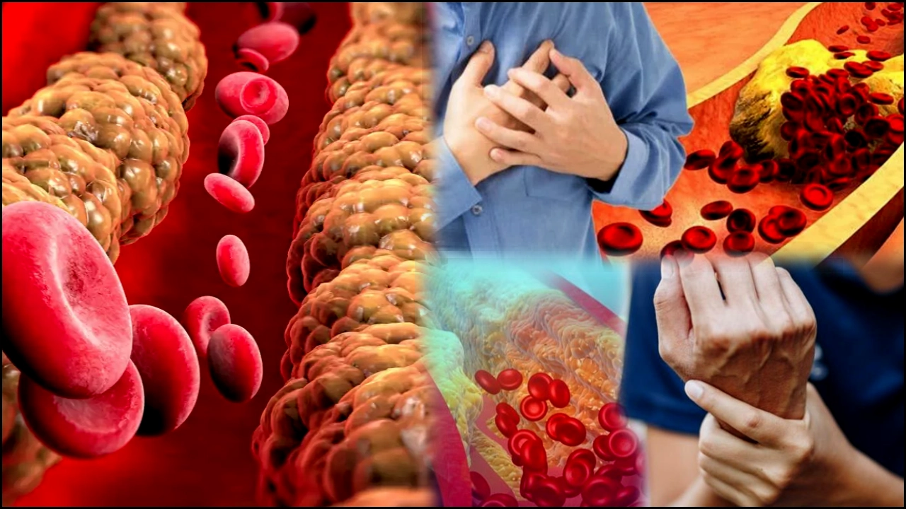 Garlic Lemon Juice : వెల్లుల్లి, నిమ్మరసం, తెేనెతో ఇలా చేస్తే.. మీ జీవితంలో గుండె జబ్బులు దగ్గరకి రావు..! Garlic Lemon Juice Reduce Cholesterol Health Tips in Telugu